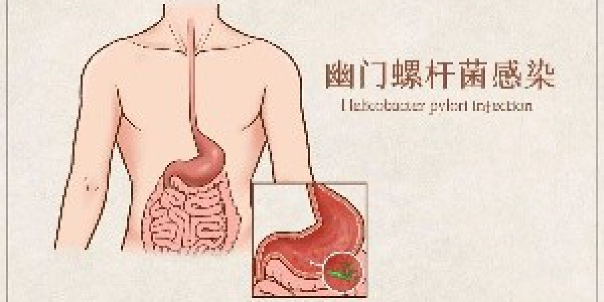 Article Picture